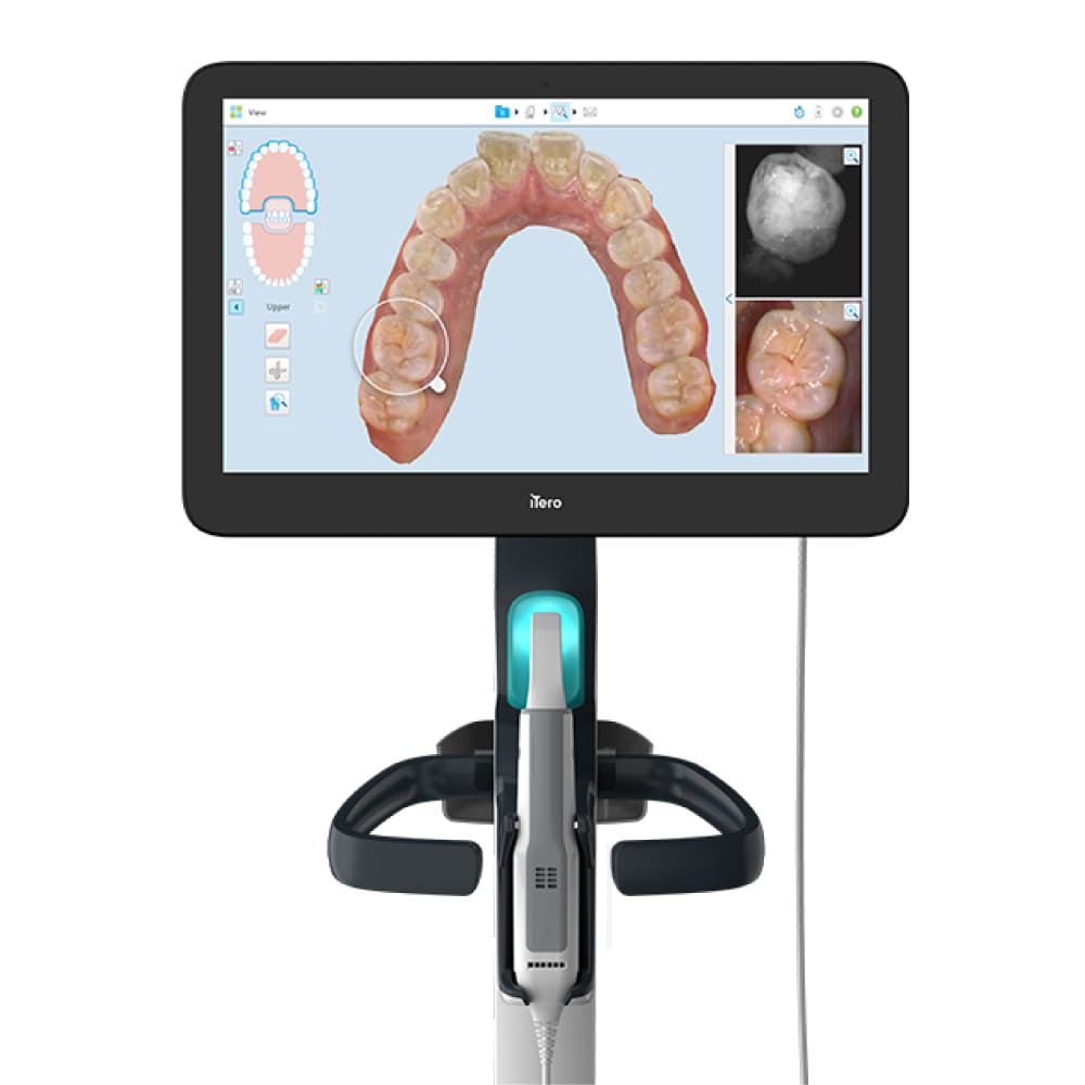 How the iTero Scanner and Invisalign Shows Your Future Smile